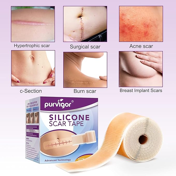 Silicone Scar Tape Roll 1.6” x 60”