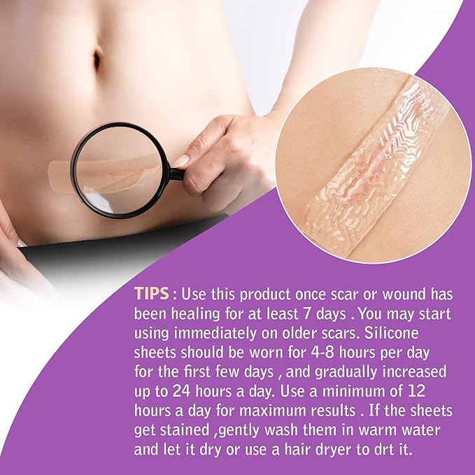 Silicone Scar Tape Roll 1.6” x 60”